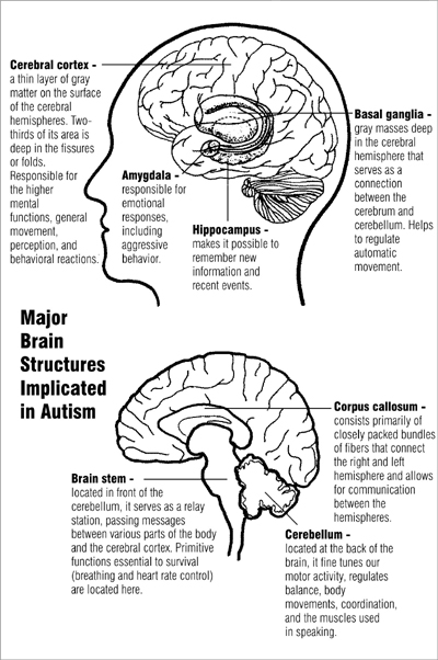 Autisic brain